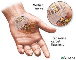 numbness and diabetes
