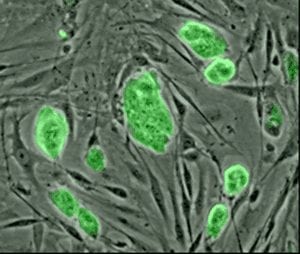 Diabetes Cure - Adult Stem Cells or Embryonic Stem Cells